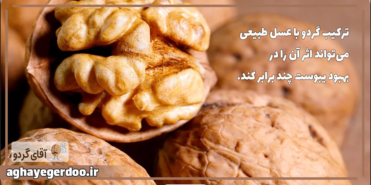 آیا گردو باعث یبوست میشود